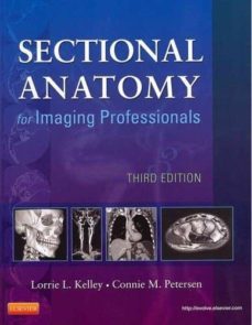 sectional anatomy for imaging professionals (3rd ed.)-9780323082600