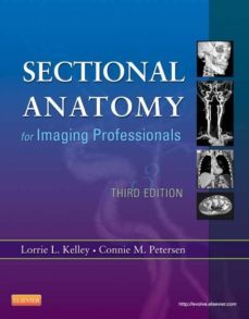 sectional anatomy for imaging professionals - e-book (ebook)-9780323277600