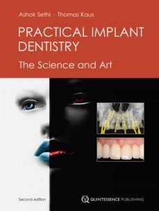 practical implant dentistry (ebook)-ashok sethi-thomas kaus-9781850974000