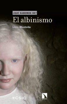 el albinismo ¿que sabemos de?-9788400104900