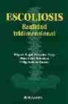 escoliosis: realidad tridimensional-9788445810200