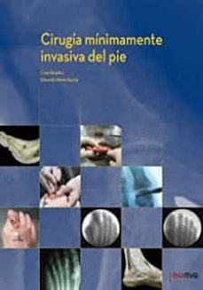 cirugia minimamente invasiva del pie-9788474296600