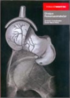 choque femoroacetabular-oliver marin peña-9788479789800