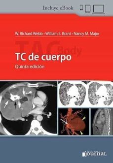 tc de cuerpo (incluye e-book)-richard webb-william e. brant-9789874922700