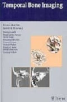 temporal bone imaging-e. hoeffner-9781588904010