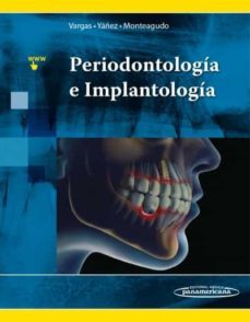 periodontologia e implantologia-ana patricia vargas casillas-beatriz raquel yañez ocampo-9786079356910