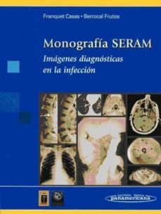 monografia seram: imagenes diagnosticas en la infeccion-tomas franquet casas-teresa berrocal frutos-9788479036010
