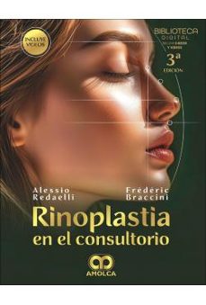 rinoplastia en el consultorio-a dedaelli-f. braccini-9786287785120