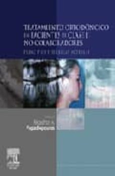 tratamiento ortodoncico en pacientes no colaboradores clase ii: principios y tecnicas actuales-9788480862820