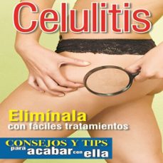Imagen Principal de Celulitis