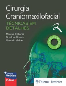 cirurgia craniomaxilofacial: tecnicas em detalhes (ebook)-marcus collares-nivaldo alonso-9786555723830