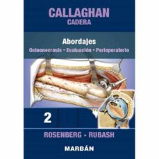 cadera 2: abordajes. osteonecrosis. evaluacion. perioperatorio-9788418068430
