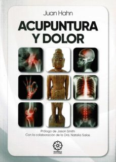 acupuntura y dolor-9788418672330