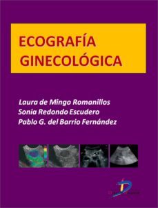 ecografia ginecologica (ebook)-laura de mingo romanillos-sonia redondo escudero-pablo g. del barrio fernandez-9788499697130