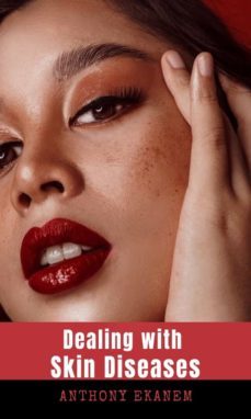 dealing with skin diseases (ebook)-anthony ekanem-9783958497740