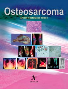 osteosarcoma (ebook)-araceli castellanos toledo-armando b. martínez ávalos-rodolfo r. rodríguez jurado-9786077411840