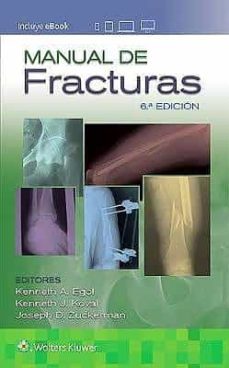 manual de fracturas-kenneth a. egol-kenneth j. koval-9788417949440