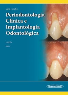 periodontologia clinica e implantologia odontologica tomo 2-jan lindhe-niklaus p. lang-9789500694940