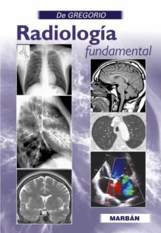 radiologia fundamental - de gregorio - premium-miguel angel de gregorio-9788418068850