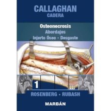 callaghan: cadera : osteonecrosis: abordajes, injerto oseo, desgaste-9788471019950