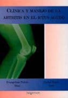 clinica y manejo de la artritis en el ictus agudo-evangelina palero diaz-carlos tejero juste-9788493563950
