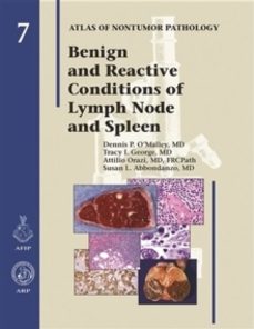 benign and reactive conditions of lymph node and spleen-dennis p. o malley-9781933477060