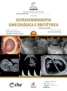 volume 15 - ultrassonografia ginecologica e obstetrica (ebook)-ronaldo hueb baroni-benito pio vitório ceccato júnior-marianna facchinetti brock-9786561030960