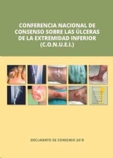 conferencia nacional de consenso sobre las ulceras de la extremidad inferior (c.o.n.u.e.i.) (2ª ed.)-josep marinel.lo roura-jose verdu soriano-9788417194260
