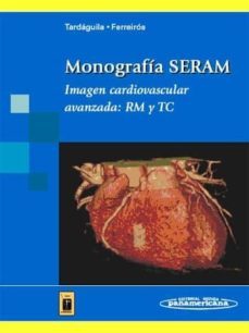 monografia seram. imagen cardiovascular avanzada: rm y tc-9788479038960