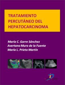 tratamiento percutaneo del hepatocarcinoma (ebook)-maria c. garre sanchez-avertano muro de la fuente-maria l. prieto martin-9788499697260