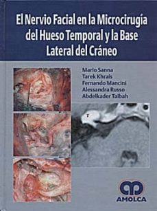 el nervio facial en la microcirugia del hueso temporal y la base lateral del craneo-9789588328560