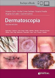 dermatoscopia (3ª ed.)-9789878452760