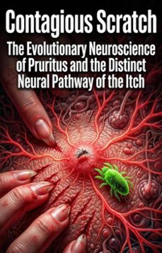 contagious scratch (ebook)-owen gallagher-9783565323470