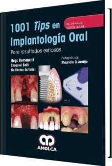 1001 tips en implantologia oral para resultados exitosos + videos online-hugo romanelli-ezequiel bolli-guillermo schinini-9789588950990