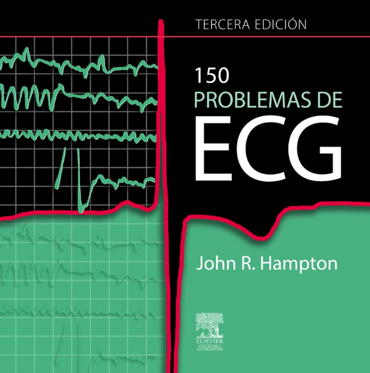 Resultado de imagen para 150 Problemas de ECG - Hampton 3ed