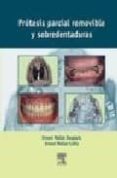 protesis parcial removible y sobredentaduras-e. mallat desplats-e. mallat callis-9788481746570 protesis parcial removible y sobredentaduras-e. mallat desplats-e. mallat callis-9788481746570