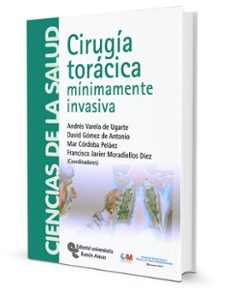 Libros de descarga de audio gratis en línea CIRUGÍA TORÁCICA (Literatura española) iBook