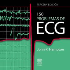 150 PROBLEMAS DE ECG EBOOK | J. R. HAMPTON | Descargar libro PDF o ...