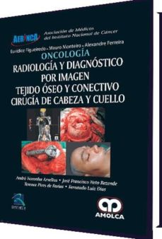 Libro electrónico descargable gratis para kindle ONCOLOGIA: RADIOLOGIA Y DIAGNOSTICO POR IMAGEN: TEJIDO OSEO Y CONECTIVO: CIRUGIA DE CABEZA Y CUELLO