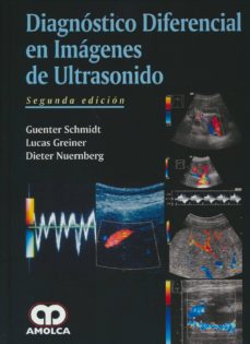 Libros gratis leídos en línea sin descargar DIAGNOSTICO DIFERENCIAL EN IMAGENES DE ULTRASONIDO (2ª ED.) (Spanish Edition)