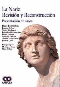 Descarga gratuita de libros de audio para kindle. LA NARIZ. REVISION Y RECONSTRUCCION: PRESENTACION DE CASOS 9789585426160 en español de H. - BREHM, J. - BRIEDIGKEIT, W. - EICHHORN-SEINS, J. - GASSNER, H. - GUBISH, W. - HILDEBRANDT, T. - QUETZ, J. BEHRBOHM