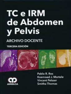 Descargar libro gratis pdf TC E IRM DE ABDOMEN Y PELVIS. ARCHIVO DOCENTE (Spanish Edition) de  CHM PDB FB2 9789588871370