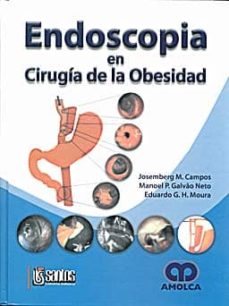 Descarga gratuita de descargadores de libros ENDOSCOPIA EN CIRUGIA DE LA OBESIDAD in Spanish  9789588328980