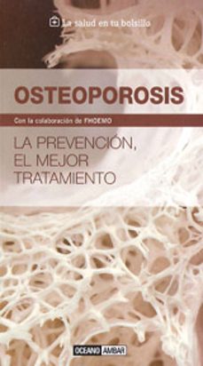 Libros gratis para descargar al ipad. OSTEOPOROSIS in Spanish